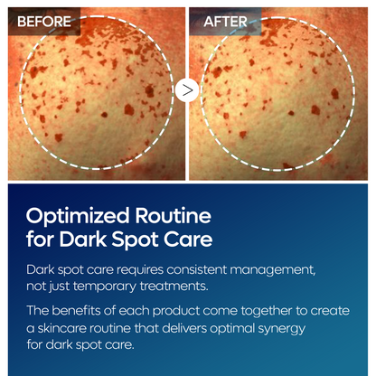 TX Tranexamic Acid Dark Spot Tone Care Line