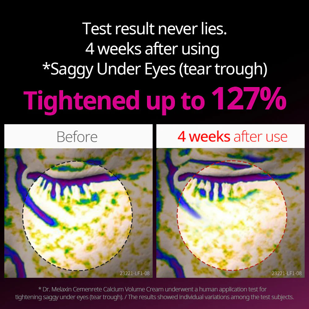 Cemenrete Eye care Line