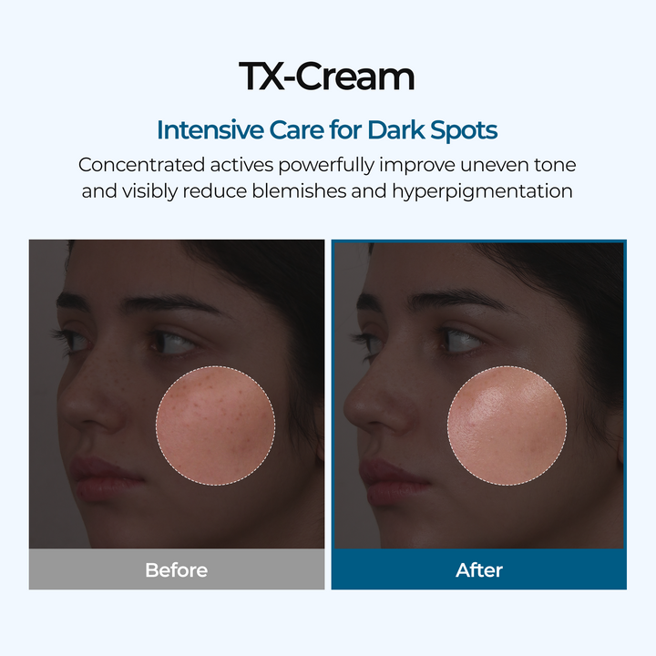 TX Cream