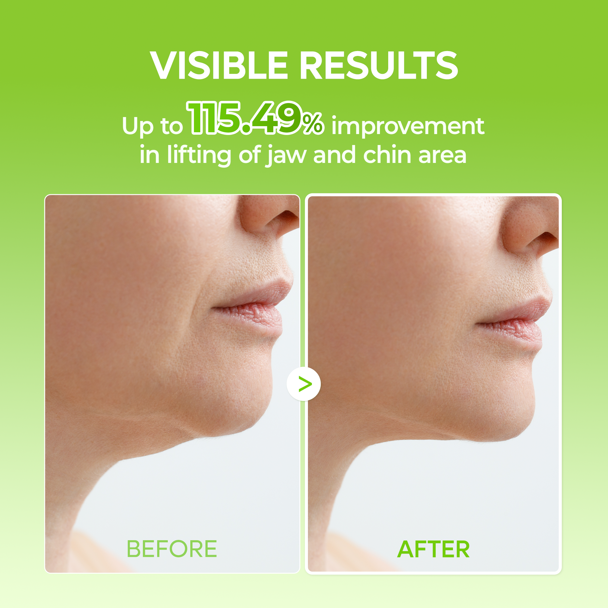 CACTOX V-Lifting Mewing Band 4EA