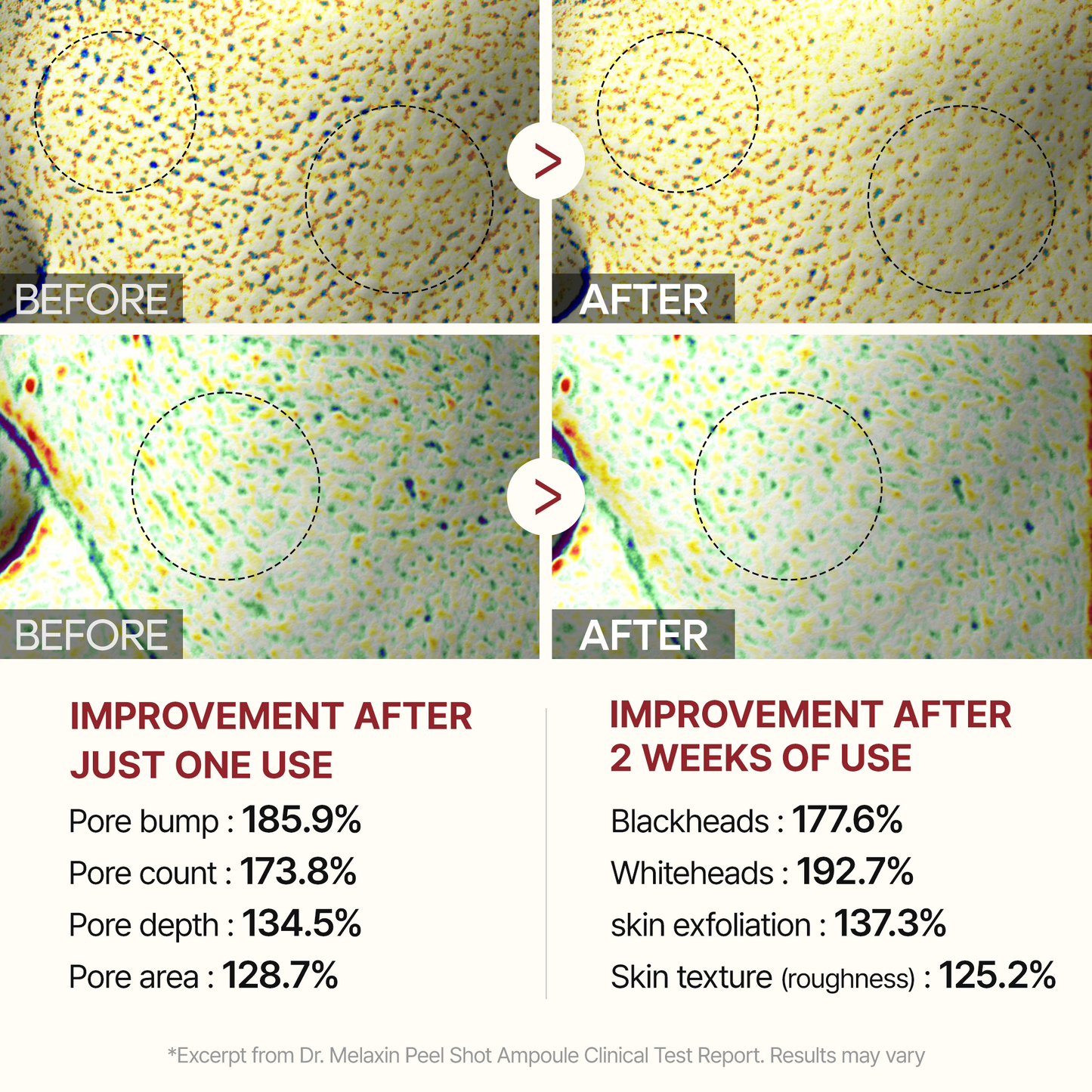 [Amazon #1] Peel Shot Black Rice Ampoule