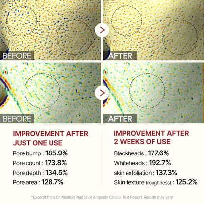 [Amazon #1] Peel Shot Black Rice Ampoule