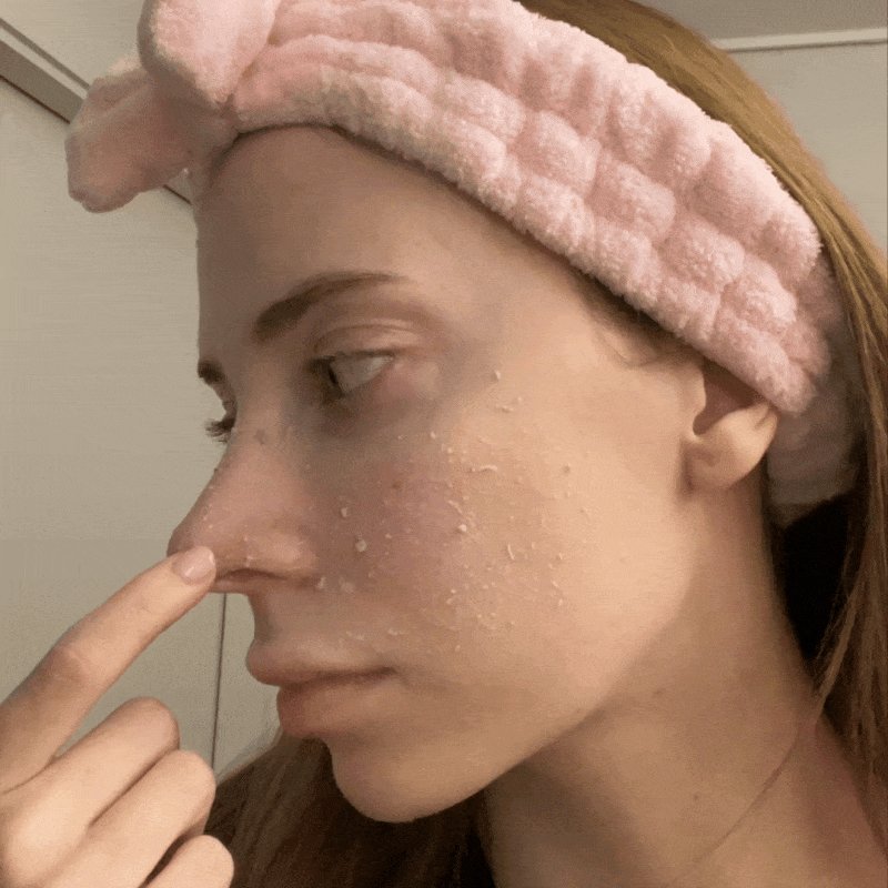 [Amazon #1] Peel Shot Black Rice Ampoule