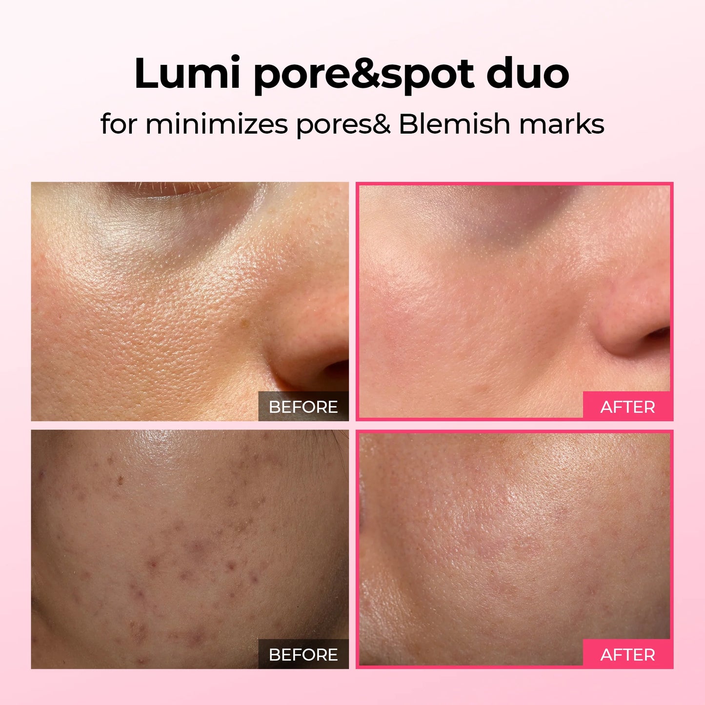 Duo Lumi Pore & Spot Care Duo