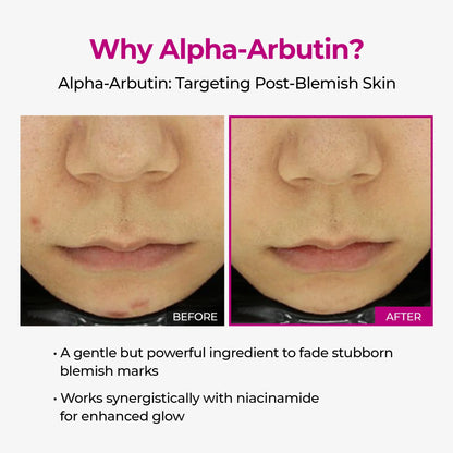 Duo Lumi Pore & Spot Care Duo